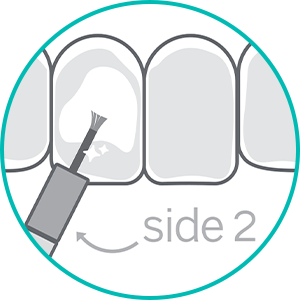 whitening bolt step 2