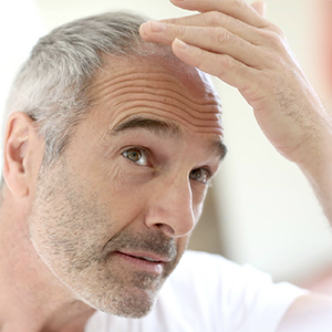FILLS IN THINNING AREAS AND BALDING SPOTS