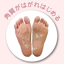 The dead skin begins to peel off