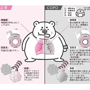 嚥下機能は耳で診る! 肺音と頚部胸部聴診法 (みどりの町のクマ