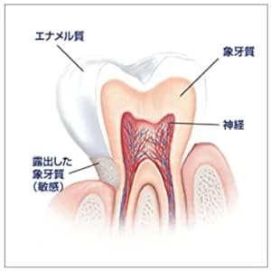 Amazon シュミテクト やさしくホワイトニングex 歯磨き粉 高濃度フッ素配合 1450ppm 医薬部外品 1本 シュミテクト ビューティー 通販
