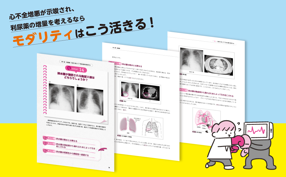 モダトレ X線、CT、心電図、エコー、MRI・MRAで薬物治療に強く