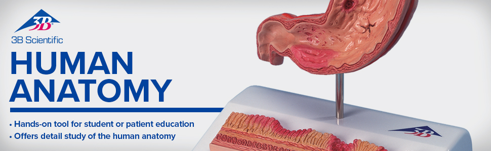 human anatomy, science, medical, patient, education, health, stomach, ulcers