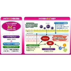 파블론 메디컬 T 거친 목구멍 세척 수리