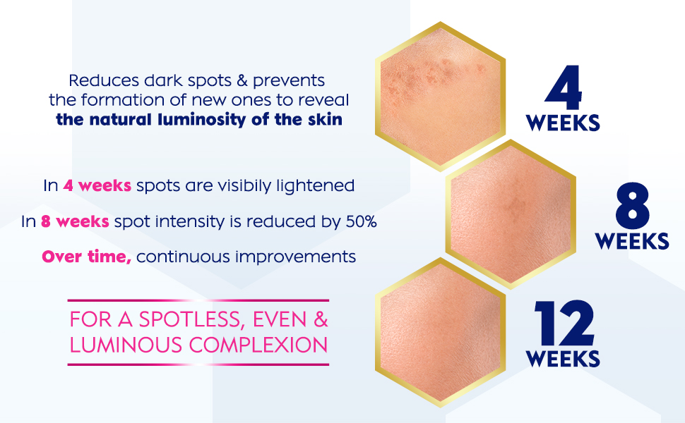 NIVEA LUMINOUS630 face spot reduction