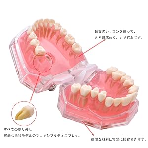 Amazon.co.jp: Angzhili 歯列模型 歯が抜く説明モデル 説明