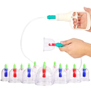 Amazon | kangzhu 「新包装」カッピング cupping 吸い玉カップ