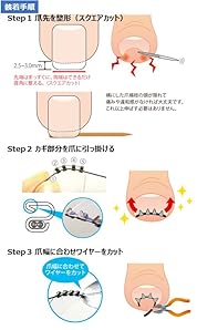 Amazon.co.jp：JPS(ジェイピーエス) まきづめリフト(ヤスリ付き