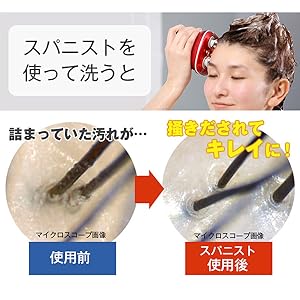 Amazon.co.jp: アデランス スパニスト 特別セット/電動 頭皮