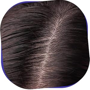 Healthy Scalp