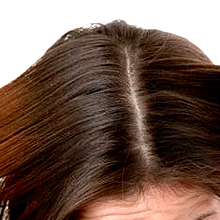 Improve-Scalp-Health