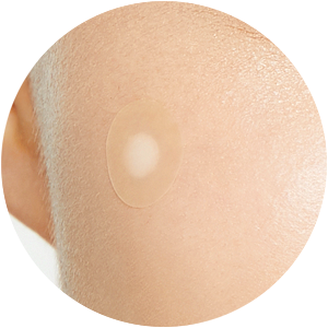 Acne Pimple Master Patch absorbs pus and flattens zits.