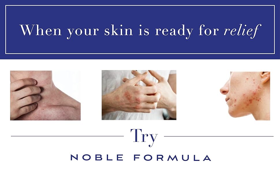 Noble Formula 2 Pyrithione Zinc (ZnP) Original Emu Bar