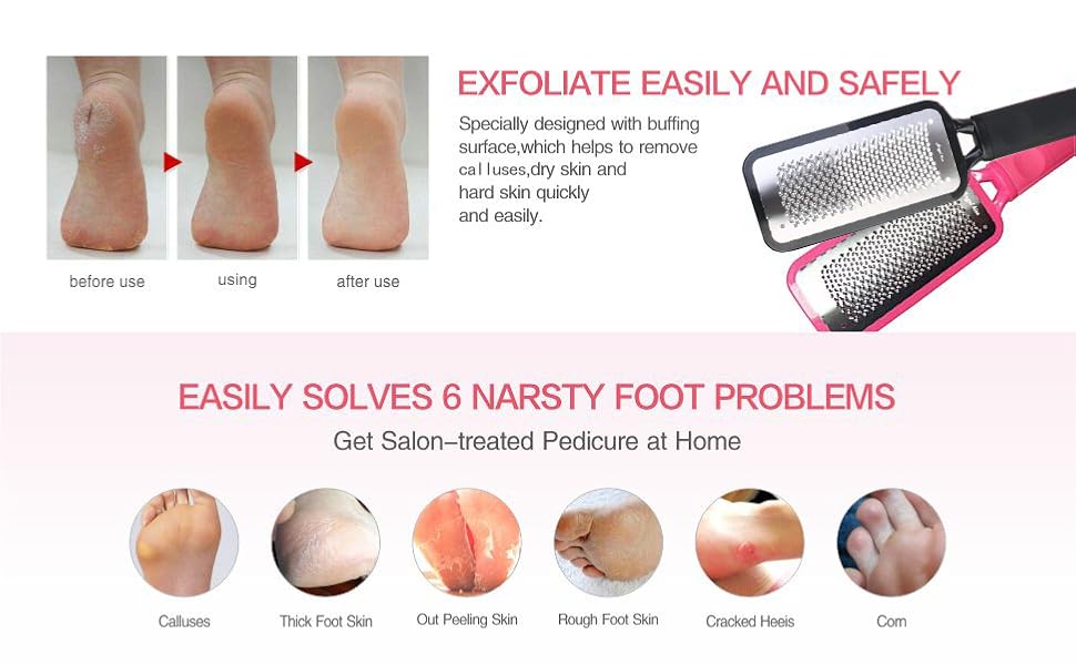 Angel Kiss Colossal Foot rasp Foot File Callus Remover