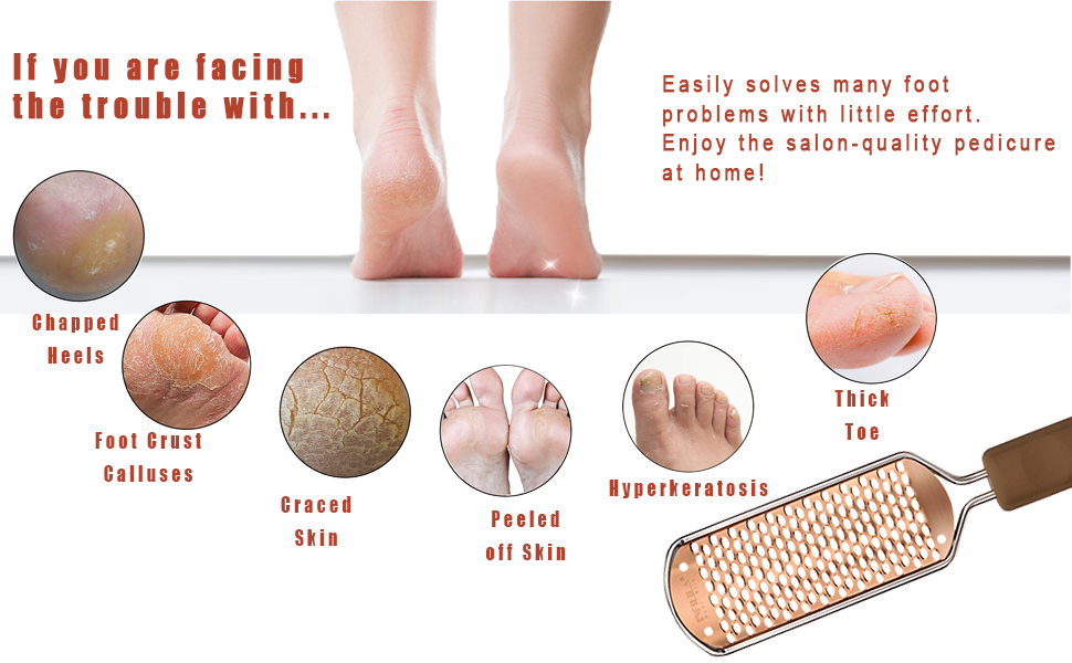 Perfect Solutions For These Problems