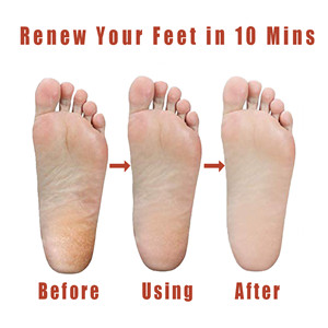 Renew Your Feet 