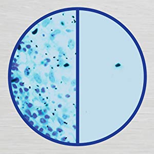 Lysol Disinfecting Wipes, Lemon and Lime Blossom