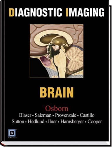 Diagnostic Imaging: Brain by Anne G. Osborn | Goodreads