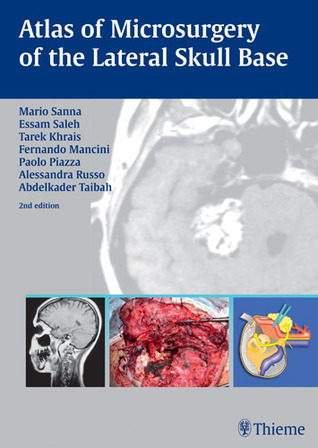 健康・医学 Atlas of Microsurgery of the Lateral S.. Atlas of Microsurgery of the Lateral Skull Base by Mario