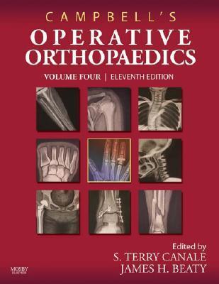 Campbell's Operative Orthopaedics: 4-Volume Set with DVD by