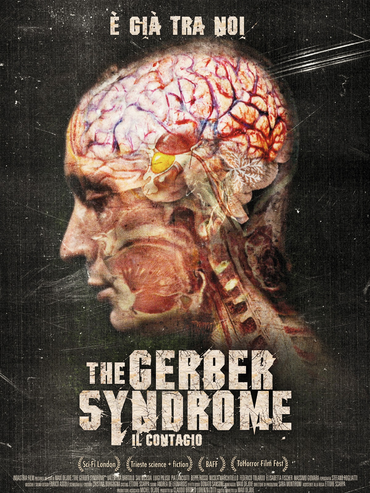 Prime Video The Gerber Syndrome Il