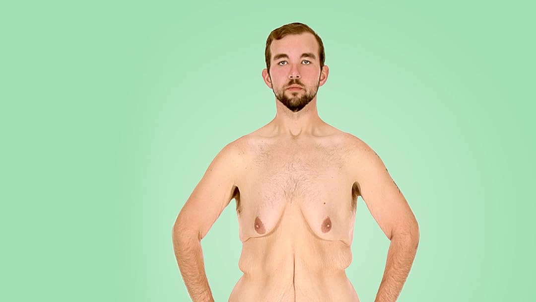 My 600-lb Life: Skin Tight