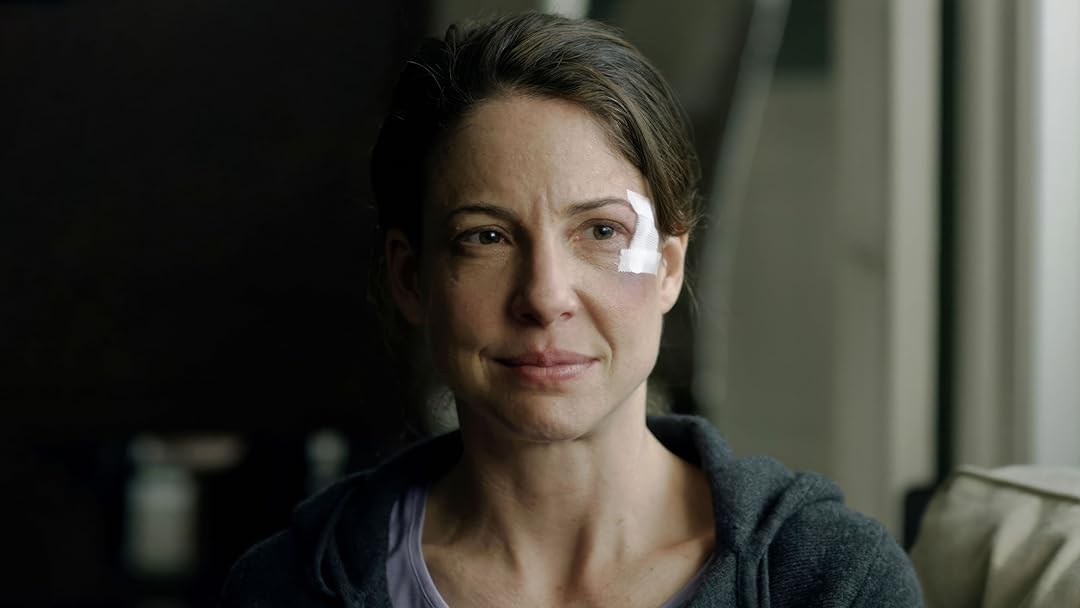 Concussion